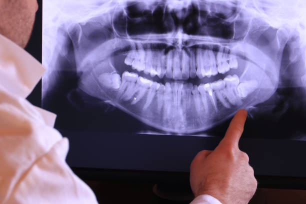 Best Chipped Tooth Repair Near Me  in Cohasset, MN
