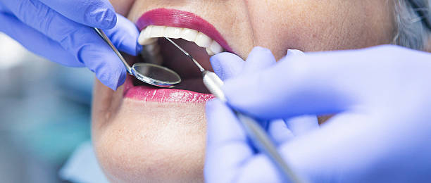 Best Chipped Tooth Repair Near Me  in Cohasset, MN